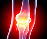 Arthritis UK